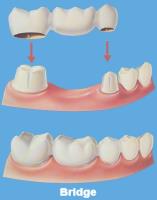 Dental Richmond - Richmond Family Dental image 1